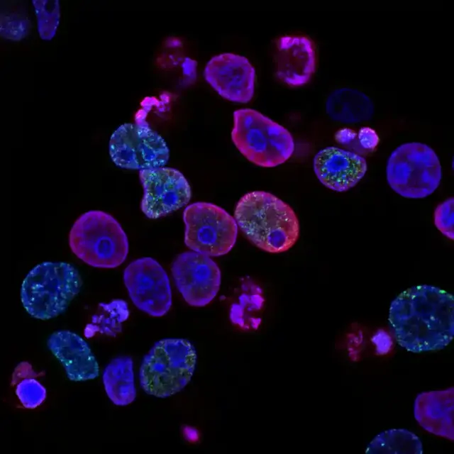 Fluorescence micrograph of stained cells