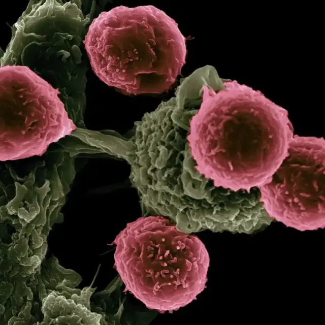 Coloured scanning electron micrograph of cells
